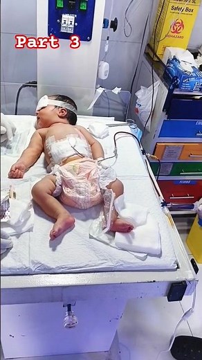 Blood Exchange in Newborns – Part 3 | Life-Saving Neonatal Procedure