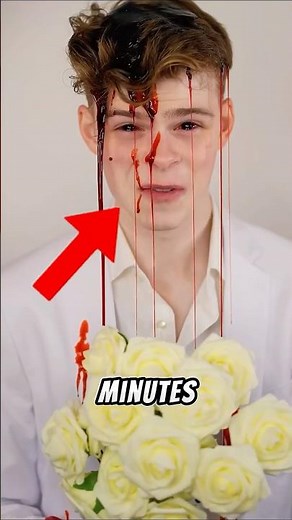 Can you survive if you lose too much blood? 😱