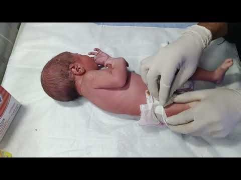 Vitamin K Injection for Newborn in NICU | First Dose Step-by-Step 💉👶