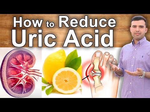 How to Lower Uric Acid and Heal Gout - What to Eat, Home Remedies and Supplements