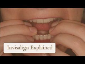 Invisalign Explained