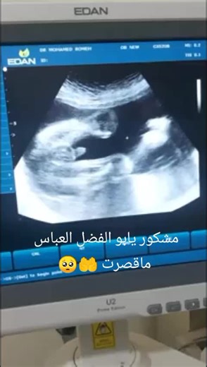 Ultrasound Images of a Developing Fetus