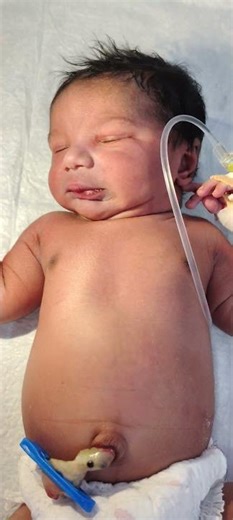 Newborn Baby Hospital Admission | Routine Medical Care