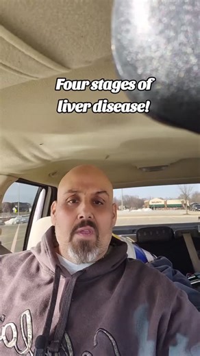 Four stages of liver disease. #LIVERFAILURE #CIRRHOSIS #addictionrecovery #alcoholism #Fibrosis #recovery #LIVERHEALTH #sobriety #sobermotivation #alcohol | Joe Dahlheimer