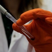 Methods for Quantitative Detection of Antibody-induced Complement Activation on Red Blood Cells