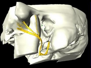 Anatomy of the Facial Nerve in the Temporal Bone without Audio