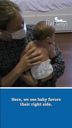 Torticollis and How to Prevent It #shorts