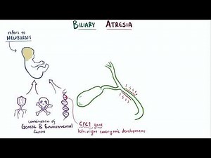 Biliary atresia - causes, symptoms, diagnosis, treatment #pediatrics