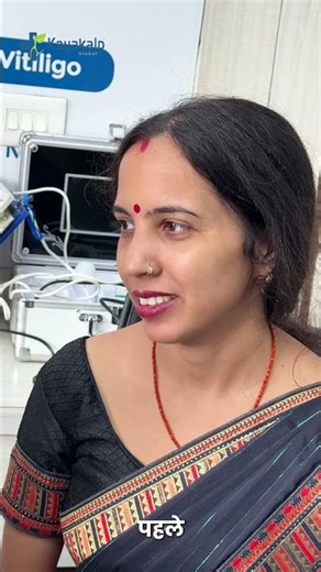 3 महीने में 70% रिकवरी! सफेद दाग रुक गया | Vitiligo Real Case #shorts #skincare #vitiligo