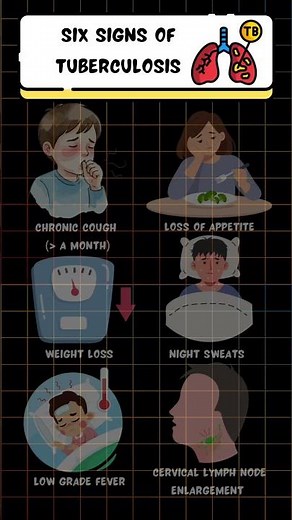 Six signs of tuberculosis