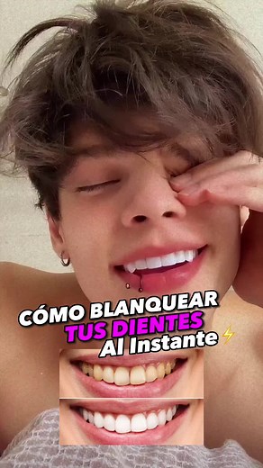 Tutorial cómo blanquear tus dientes y tener una sonrisa perfecta al instante, te hará muy atractivo!⚡️ #glowup #glowuptips #atractivo #whiteteeth