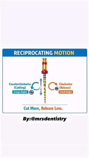 Dr. Zainab | Dentist 🦷 on Instagram: "✅ Reciprocating Motion 1️⃣ Definition • Reciprocating motion is a back-and-forth rotational movement of the endodontic file. 2️⃣ How it works • File rotates in two directions alternately: • Counterclockwise (CCW) → larger angle (Cutting) • Clockwise (CW) → smaller angle (Release) 3️⃣ Cutting mechanism • CCW rotation cuts dentin and shapes the canal. • CW rotation disengages the file to reduce locking. 4️⃣ Key concept • Cut more, release less • That’s why it