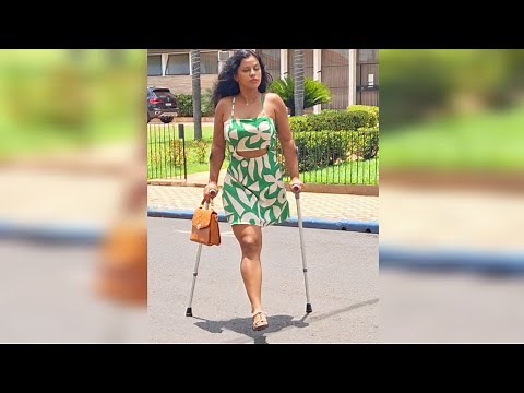 Strong Amputee Woman Crutching 💕 Amputee Girl Lifestyle, Story, motivation,inspiration, positivity.