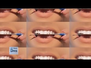 Why Are Kids DIY Filing Their Teeth with Nail Files?