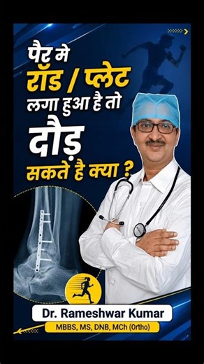 हड्डी में रॉड या प्लेट लगी है? क्या आप दौड़ सकते हैं? | Can You Run With a Rod or Plate in Your