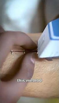 Surgical Staples || placing And Removing of surgical stapler || Skin Stapler || staple skin dr raj