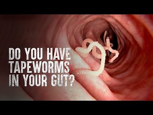 Unveiling Tapeworms - Prevention, Treatment, and Health Tips (3 Minutes)