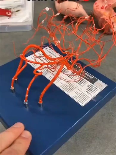 🧠 Circle of Willis — The Brain’s Life-Saving Backup System! Ever wondered how your brain keeps working even if one artery gets blocked? 🤯 Meet the Circle of Willis — a ring-like arterial network at the base of the brain that maintains cerebral blood flow when things go wrong. 🔁 Acts as a collateral pathway 🧠 Protects against ischemia & stroke 📍 Formed by: • Anterior cerebral arteries • Anterior communicating artery • Internal carotid arteries • Posterior communicating arteries • Posterior c