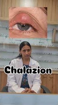 eyelid swellings causes and treatment #eyes