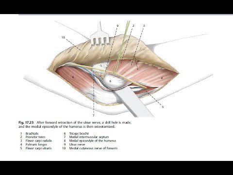 Medial Approach to the Elbow