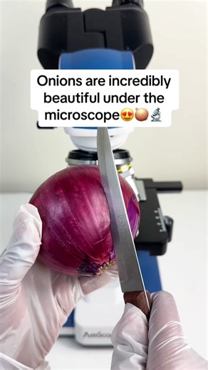 It looks amazing #microscope #onions