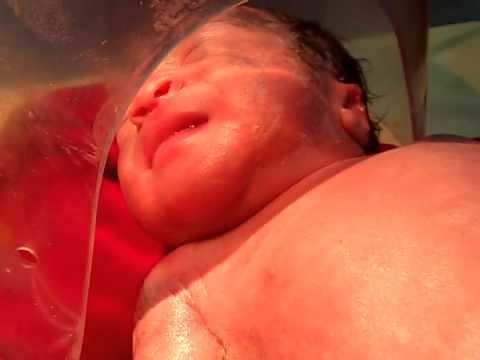 Medical Education Video: Neonatology: Grunt- Respiratory distress in newborn