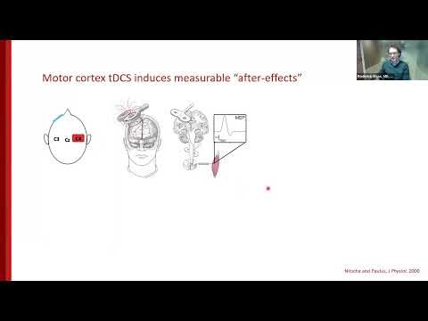 All About Transcranial direct-current stimulation (tDCS)