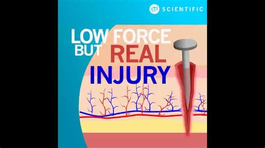 How Much Force Does It Take to Penetrate Skin? | GTD Scientific Inc.