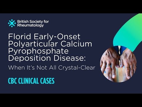 Florid Early-Onset Polyarticular Calcium Pyrophosphate Deposition Disease | Case-Based Conference