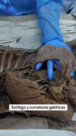 Esófago y curvaturas del estómago: Anatomía esencial