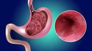 2D animation. Gastric mucosa. Digestive endoscopy or gastroscopy. Performing a gastroscopy procedure. Diagnostics of gastric diseases. Stomach health. Medical concept