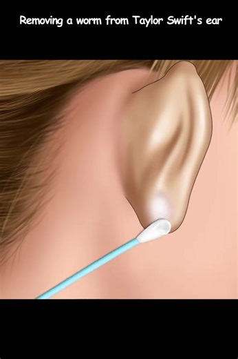 50K views · 260 reactions | ASMR Animation Removing a worm from Taylor Swift's Ear #removal #asmr #asmranimation | Video Farm | Facebook