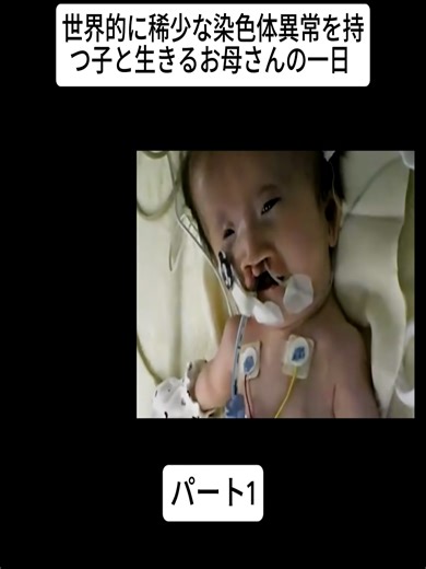 世界的に稀少な染色体異常を持つ子と生きるお母さん