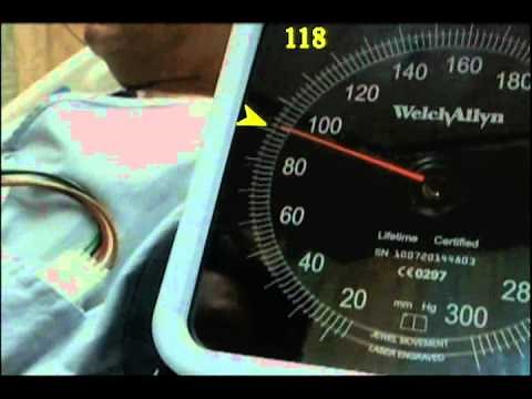 How to Measure Pulsus Paradoxus - (Real Patient!) - Stanford Medicine 25