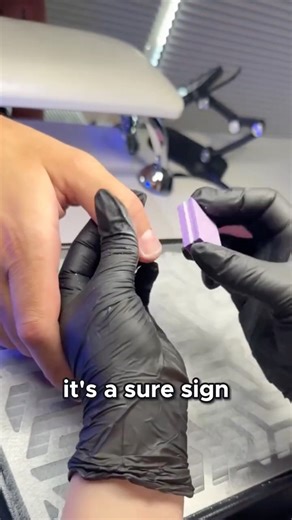 Men vs Women: The Cuticle Difference Explained