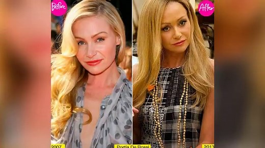 Portia De Rossi Claims She’s Not Chasing Age 20 With Plastic Surgery