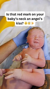 31K views · 247 reactions | What’s an “Angel Kiss” on a Newborn?...