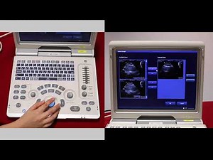 Mindray Z6: How to create a report on the Z6 - video 6