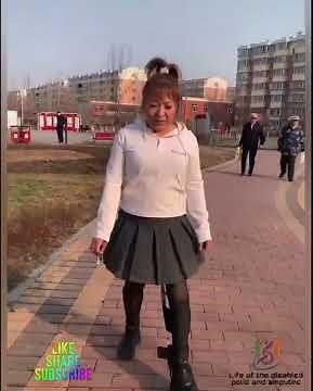 The beautiful woman with polio walks on an orthosis #disability