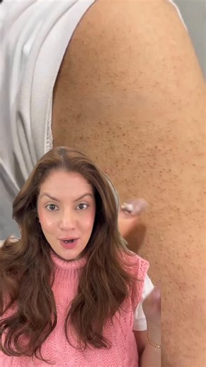 Nipun Kapur Sohal | Skincare Educator on Instagram: "Strawberry skin (KP) isn’t dirt. It’s basically trapped keratin + rough follicles — and you need a BODY routine that’s consistent, not aggressive. 🍓✨ In the video, I’m showing you my simple rotation: ✅ Retinol-based body lotion (2–3x/week) → follow with moisturiser ✅ On the other nights: AHA/BHA body lotion → follow with moisturiser Now, as promised… BONUS TIPS👇 1) Use an African net sponge (the real one). Look for an authentic African net s