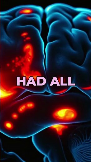 ADHD Brain Scan: Unlock the 7 Types of ADHD