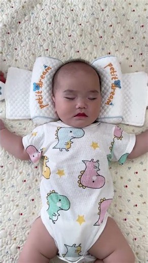 Baby's Odd Sleep Position: The Curious Case of a Crooked Head