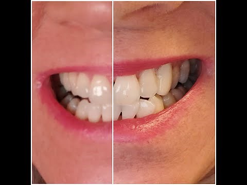 Crest Whitestrips 1-Hour Express | Two Uses | Honest Review | KimTownselYouTube