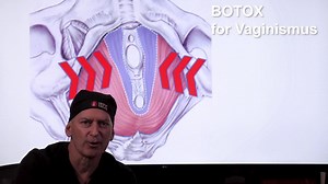 Vaginismus treated with Botox Therapy