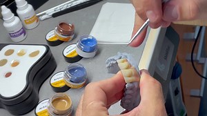 🎥 UPCERA EXPERT CLUB | Mastering DUO Artouch by Oswaldo Malfacini Join Oswaldo Malfacini, a seasoned expert with over 15 years in the field, as he demonstrates his mastery of dental artistry. This showcase features a dental bridge crafted with precision using DUO Multilayer Zirconia and the Artouch Glaze & Stain System, resulting in seamless color transitions and natural gingival harmony. Don't miss the opportunity to delve into the process behind this dental masterpiece. The video offers a gli