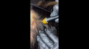 Up close and personal with Keravive 🔍 The Keravive treatment is designed for all scalp hair types ✨ @hydrafacial_uk #hydrafacialuk #hydrafacial #skintreatment #healthyskin #skinhealth #skincare #LVBXUK | Changes Clinic