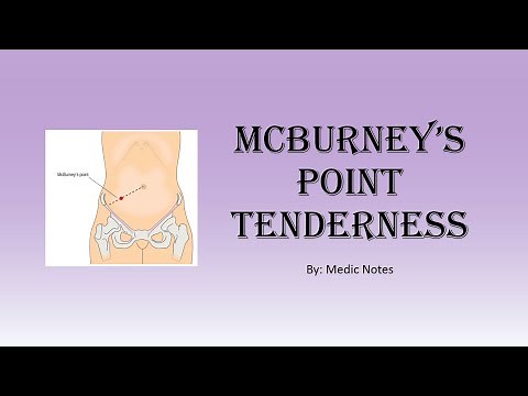Mcburney's point tenderness