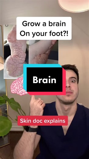 Proteus Syndrome: Mole on Your Toe Explained by a Dermatologist