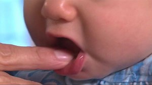 50K views · 195 reactions | Spot the signs that your little one has started teething, and learn about remedies that can ease baby's discomfort. #ad | What To Expect | Facebook