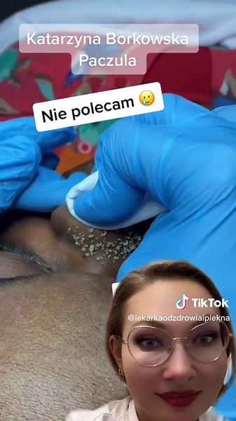 #greenscreenvideo wągry( zaskórniki ) występują w miejscach, gdzie mamy najwięcej gruczołów łojowych. Mogą być czarne lub białe. Jak sobie z nimi radzicie ? Wyciskacie ? #fuj #wyciskanie #tradzik #estetycznenotatki #twarzing